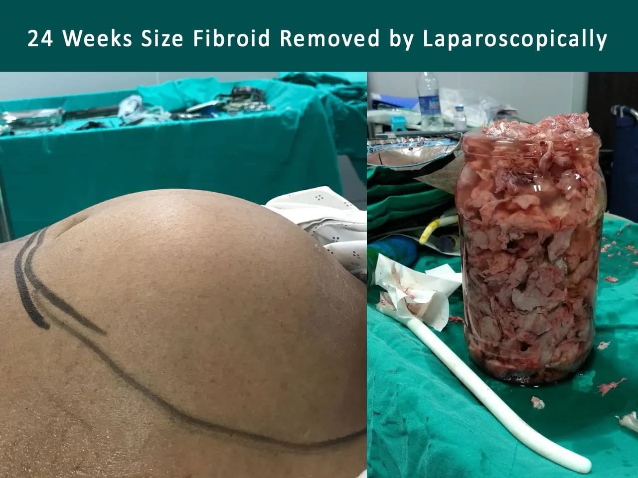 Best Gynecologist in Jaipur - Dr. Vibha Chaturvedi Sharma — photo gallery 15
