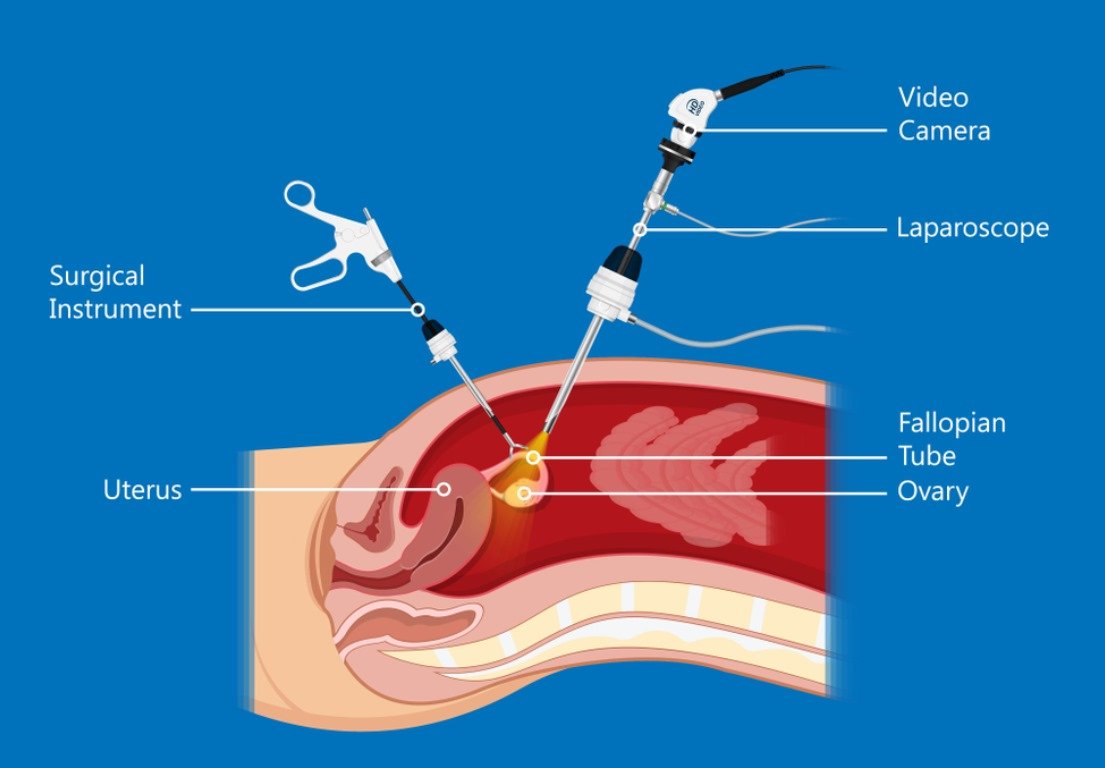 Best Gynecologist in Jaipur - Dr. Vibha Chaturvedi Sharma